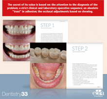 Load image into Gallery viewer, 3Step Additive Prosthodontics by Francesca Vailati